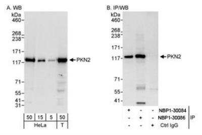 Western Blot: PKN2 Antibody [NBP1-30086]