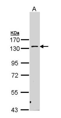 Western Blot: PKN2 Antibody [NBP1-31367]