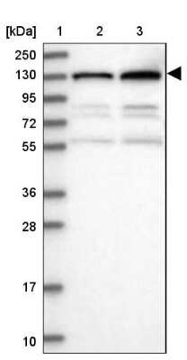 Western Blot: PKN2 Antibody [NBP2-13766]