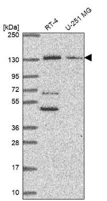 Western Blot: PKN2 Antibody [NBP2-68736]