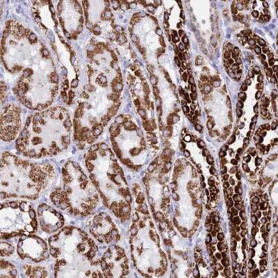 Immunohistochemistry-Paraffin: PKN3 Antibody [NBP2-33444]