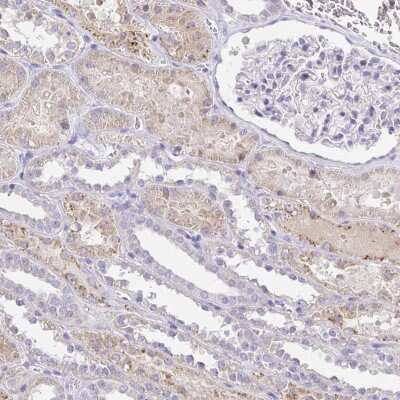 Immunohistochemistry-Paraffin: PKN3 Antibody [NBP2-38849]