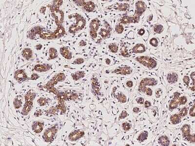 Immunohistochemistry-Paraffin: PKN3 Antibody [NBP2-98608]