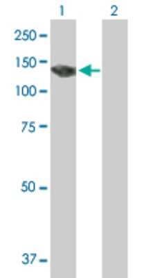 Western Blot: PKN3 Antibody [H00029941-B01P]