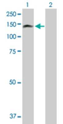 Western Blot: PKN3 Antibody [H00029941-D01P]