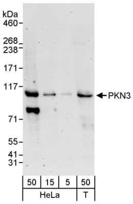 Western Blot: PKN3 Antibody [NBP1-30102]