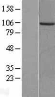 Western Blot: PKN3 Overexpression Lysate [NBL1-14464]