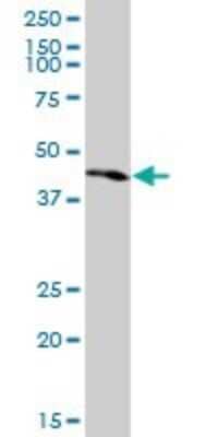 Western Blot: PKNOX1 Antibody (1F12) [H00005316-M13]