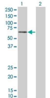 Western Blot: PKNOX1 Antibody (2A12) [H00005316-M07]