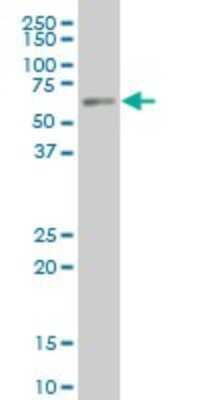 Western Blot: PKNOX1 Antibody (2B3) [H00005316-M05]