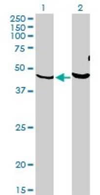 Western Blot: PKNOX1 Antibody (2B3) [H00005316-M05]