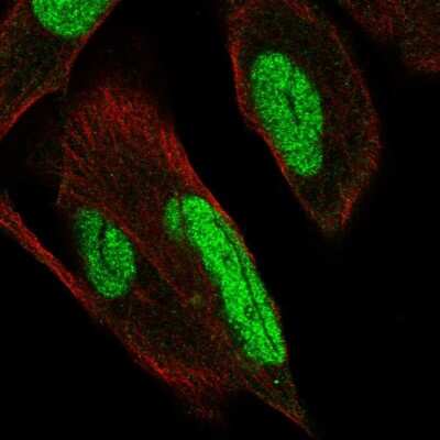 Immunocytochemistry/ Immunofluorescence: PKNOX1 Antibody [NBP2-57710]