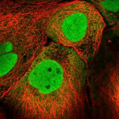 Immunocytochemistry/ Immunofluorescence: PKNOX1 Antibody [NBP2-58191]