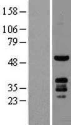 Western Blot: PKNOX1 Overexpression Lysate [NBL1-14465]