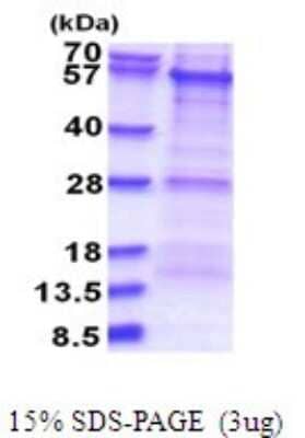 SDS-PAGE: Recombinant Human PKNOX1 His Protein [NBP2-51713]