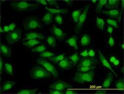 Immunocytochemistry/ Immunofluorescence: PKNOX2 Antibody (4B6) [H00063876-M01]