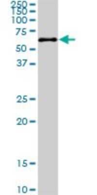 Western Blot: PKNOX2 Antibody (4B6) [H00063876-M01]