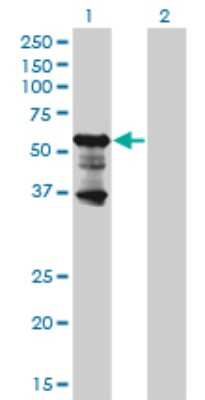 Western Blot: PKNOX2 Antibody (4B6) [H00063876-M01]