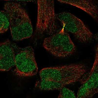 Immunocytochemistry/ Immunofluorescence: PKNOX2 Antibody [NBP2-55463]