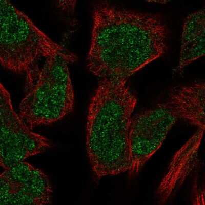 Immunocytochemistry/ Immunofluorescence: PKNOX2 Antibody [NBP2-57402]