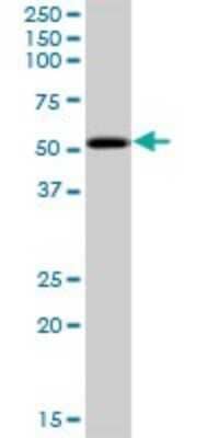 Western Blot: PKNOX2 Antibody [H00063876-B01P]