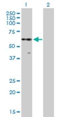 Western Blot: PKNOX2 Antibody [H00063876-B01P]