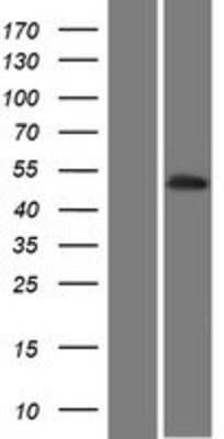 Western Blot: PKNOX2 Overexpression Lysate [NBP2-06480]