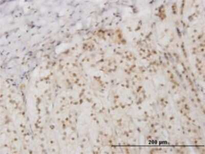 Immunohistochemistry-Paraffin: PKR Antibody (1D11) [H00005610-M02]