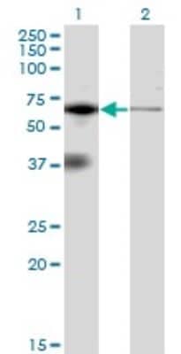 Western Blot: PKR Antibody (1D11) [H00005610-M02]