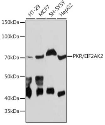 Western Blot: PKR Antibody (5B7B6) [NBP3-15767]