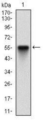 Western Blot: PKR Antibody (6H3A10)BSA Free [NBP2-37242]