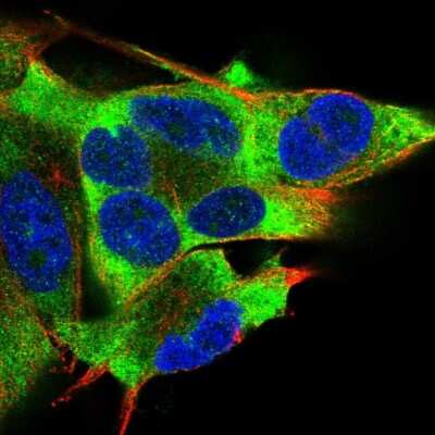 Immunocytochemistry/ Immunofluorescence: PKR Antibody [NBP2-57020]