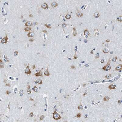 Immunohistochemistry-Paraffin: PKR Antibody [NBP1-84878]