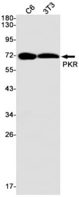 Western Blot: PKR Antibody (S04-3F2) [NBP3-19538]