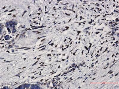 Immunohistochemistry-Paraffin: PKR Antibody (S08-2C8) [NBP3-19517]