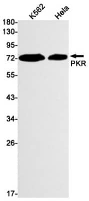 Western Blot: PKR Antibody (S08-2C8) [NBP3-19517]