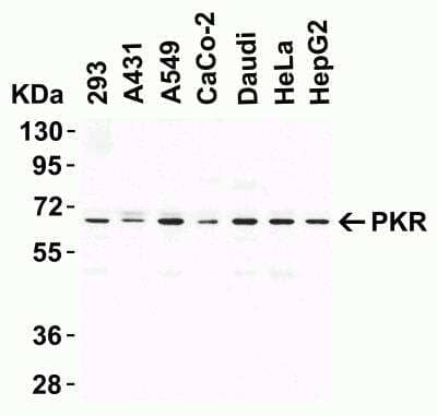 Western Blot: PKR AntibodyBSA Free [NBP1-77266]