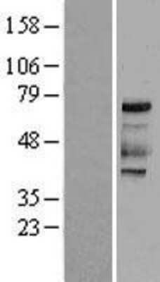 Western Blot: PKR Overexpression Lysate [NBL1-10176]