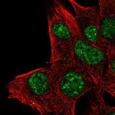 Immunocytochemistry/ Immunofluorescence: PLA1A Antibody [NBP2-58599]