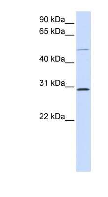 Western Blot: PLA1A Antibody [NBP1-58036]