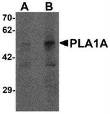 Western Blot: PLA1A AntibodyBSA Free [NBP2-82024]