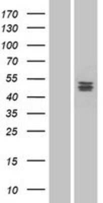 Western Blot: PLA1A Overexpression Lysate [NBP2-07115]