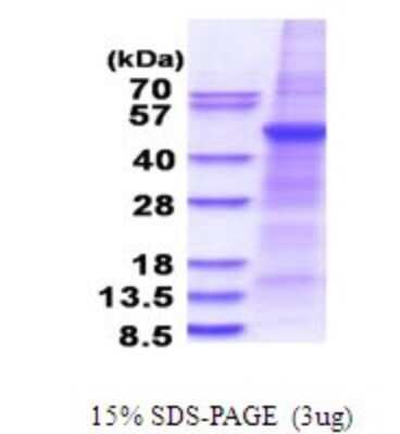 SDS-PAGE: Recombinant Human PLA1A His Protein [NBP2-51674]