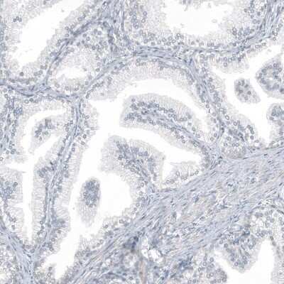 Immunohistochemistry-Paraffin: PLA2G10 Antibody [NBP1-93706]