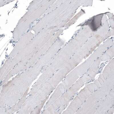 Immunohistochemistry-Paraffin: PLA2G10 Antibody [NBP1-93706]