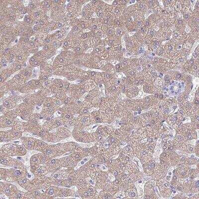 Immunohistochemistry-Paraffin: PLA2G12B Antibody [NBP2-31685]