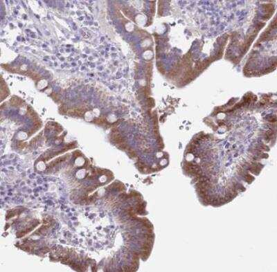 Immunohistochemistry-Paraffin: PLA2G12B Antibody [NBP2-31685]