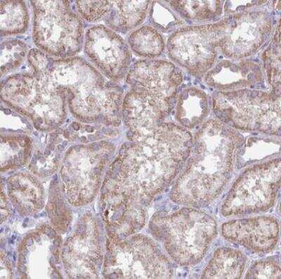 Immunohistochemistry-Paraffin: PLA2G12B Antibody [NBP2-31685]
