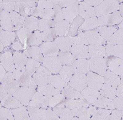 Immunohistochemistry-Paraffin: PLA2G12B Antibody [NBP2-31685]