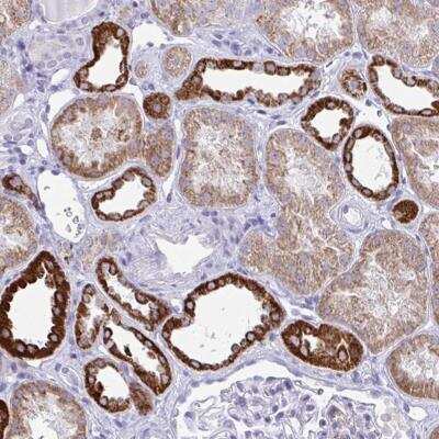 Immunohistochemistry-Paraffin: PLA2G12B Antibody [NBP2-31780]